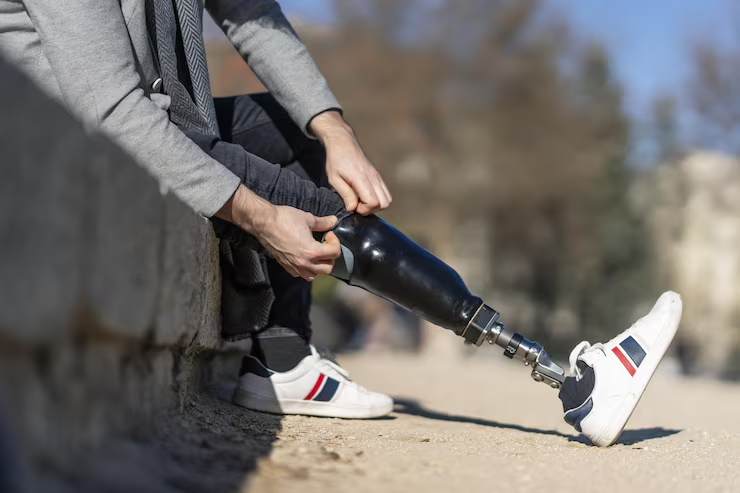 What to Expect During Your First Prosthetic Services Appointment